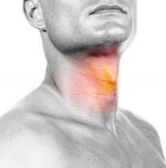Laringite da reflusso gastroesofageo: localizzazione del mal di gola
