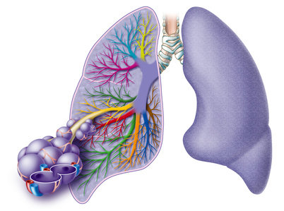 sarcoidosi-polmoni